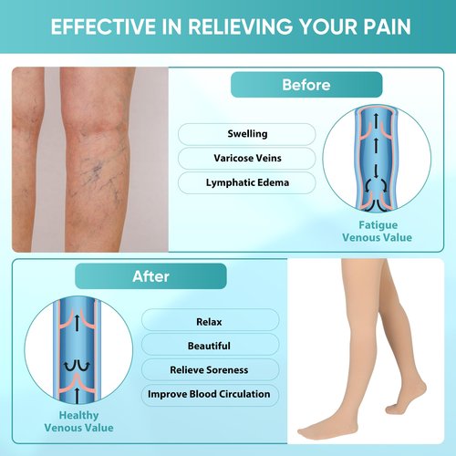 JYUOZI Compression Pantyhose Stockings for Women Men, 20-30 mmHg Closed Toe Medical Waist High Compression Stockings, Support Compression Hose Tights for Varicose Veins, Swelling(Beige, M)