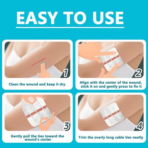 10PCS Wound Closure Strips, Butterfly Bandages Emergency Laceration Closure Kit Repair Wounds Without Stitches, Quick Clot Zip Stitch Wound Closures Device