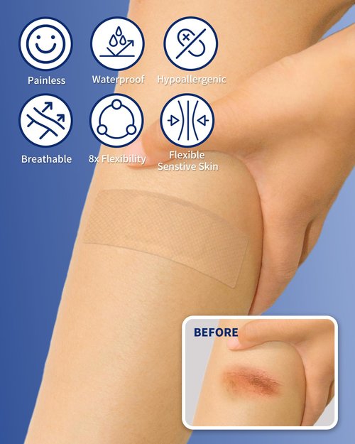 CareUs Pro Elastic & Waterproof Bandages,Latex Free - 20 Count, 1.6 x 4 Inch, Skin-Friendly, 8X Flexibility, Ideal for Sensitive Skin, Gifts for Mom