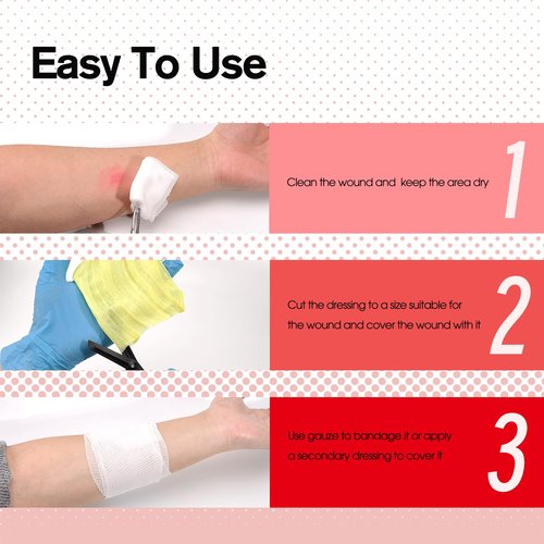 POLYNEW Xeroform Petrolatum Dressing 5"x9", 25 PCS Non-Adherent Gauze for Low Exudating Wounds, Fine Mesh Gauze Pads for Burns, Abrasions, Lacerations, Skin Grafts and Surgical Incisions