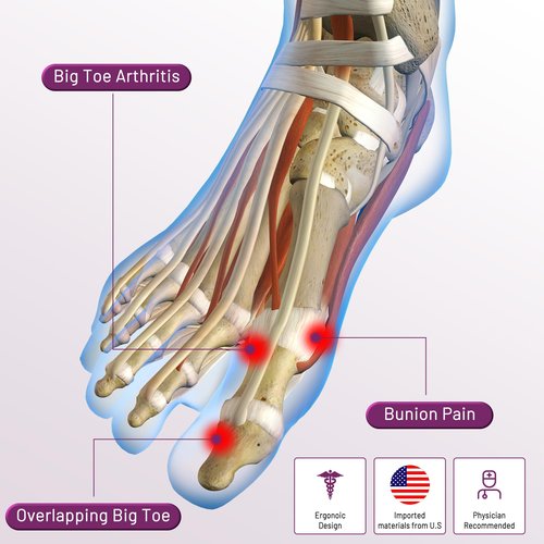 Bunion Corrector Sleeve, Breathable Bunion Big Toe Alignment Splint with Anti-Slip Heel Grip,4 Sizes,Extra Thick Gel Pads & Adjustable Straps for Hallux Valgus Comfort. (Beige, M:WOMEN 7.5-9/MEN 5-7)