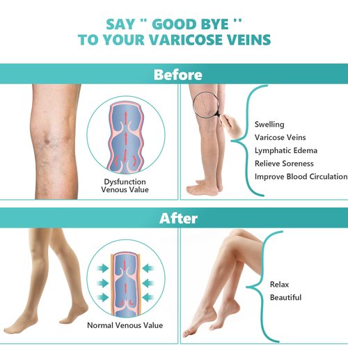 Compression Pantyhose Stockings for Women Men, 20-30 mmHg Medical Graduated Support Opaque Closed Toe Hose Tights