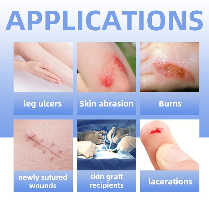 Dr. Med Silver Calcium Alginate Wound Dressing 4"x4" - 5 Pack Non-Adhesive Absorbent Gauze