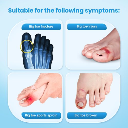Big Toe Splint for Women & Men, Broken Big Toe Support Brace for Fracture Fixation,Sports Sprains,Injuries, Adjustable Big Toe Protector with 2 Stainless Steel Plates for Day & Night - Right（Beige）
