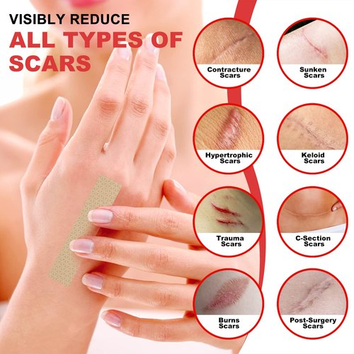 FRESINIDER Silicone Scar Sheets - Extra-Large 5.9"x2.4" for Enhanced Coverage | Pack of 8 for Effective Scar Treatment