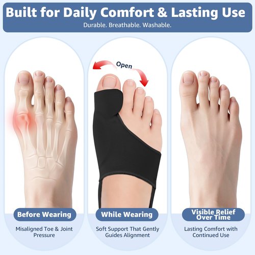Kandaro Bunion Corrector 2-Pack for Women & Men – Big Toe Straightener Sleeve with Toe Separator, Relieves Hallux Valgus & Bunion Pain – Comfortable Day & Night Wear (Black)