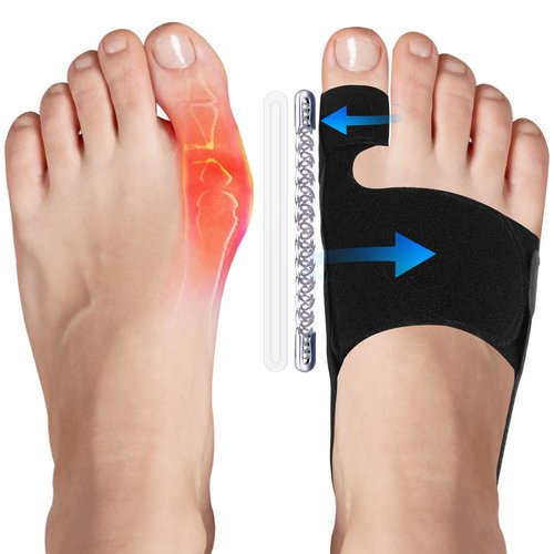 TISMOD 2 Pack Bunion Corrector,Big Toe Straightener for Women & Men, Adjustable, Breathable Splint for Hallux Valgus Pain Reduce，,Fits Left/Right Feet