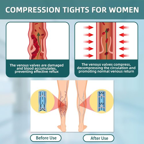 2 Pairs 20-30mmHg Compression Pantyhose for Women, Medical Graduated Compression Stockings Leggings Footless Support Compression Tights for Varicose Veins, Swelling, Edema (Black+ Beige)