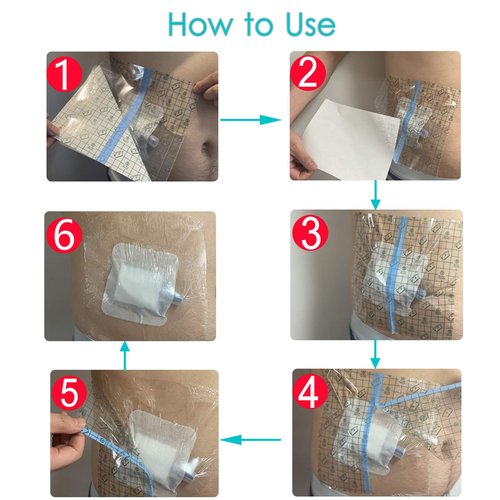 Waterproof Shower Cover Shields Dialysis Port Picc Line Chest Catheter PD Peritoneal Dialysis Chemo Non-Stick Center Pad for Feeding Tube Peg G-Tube Patient Bandage Protector, 10"x10"(Pack of 25)