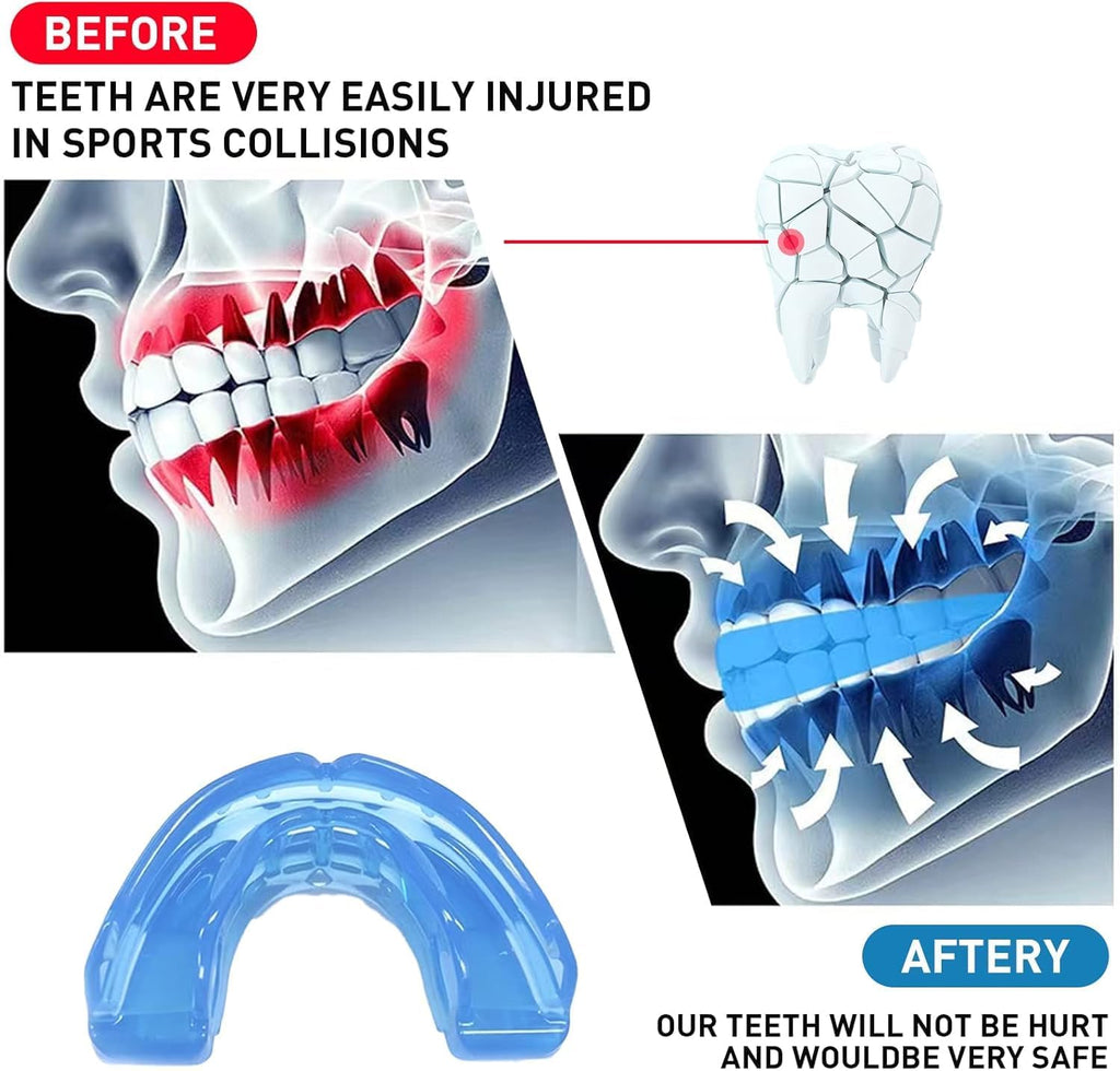 Skiennix Kids Mouth Guard - Durable Sports Braces for Football, MMA, Boxing & More | Blue with Case