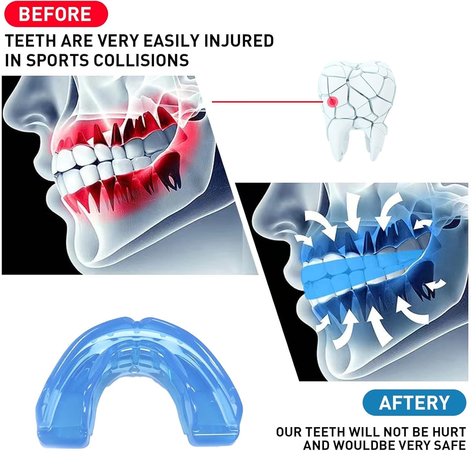 Skiennix Kids Mouth Guard - Durable Sports Braces for Football, MMA, Boxing & More | Blue with Case