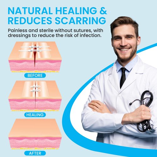 Antaly Wound Closure Strips, Zip Stitch Laceration Closure Kit, 12 PCS Butterfly Closure Bandages with Alcohol Pad & Dressings, Quick Clot Repair Wounds Without Stitches