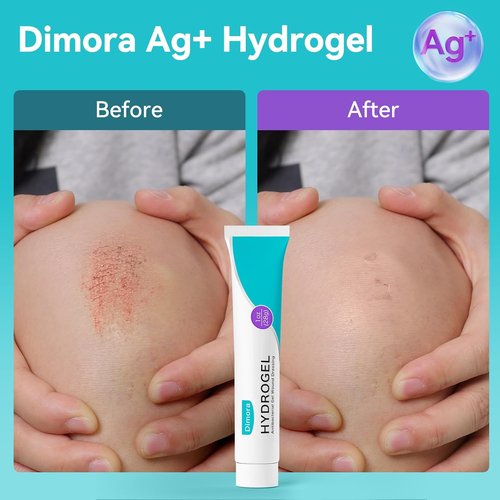 Dimora Antibacterial Gel Wound Dressing | 3 Packs of 3oz Silver Hydrogel for Soothing & Healing Cuts