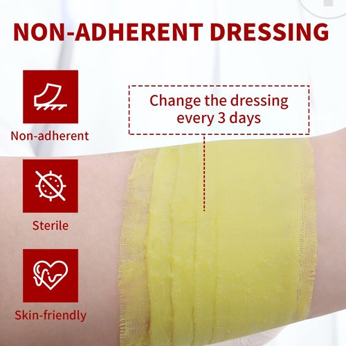 POLYNEW Xeroform Petrolatum Dressing 5"x9", 25 PCS Non-Adherent Gauze for Low Exudating Wounds, Fine Mesh Gauze Pads for Burns, Abrasions, Lacerations, Skin Grafts and Surgical Incisions