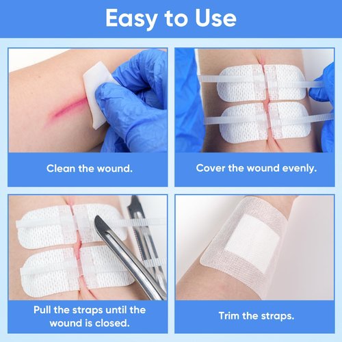 VPRIME SAFETYFY 34 Pack Wound Closure Strips, Zip Stitches Wound Closure Kit 6PCS Repair Wounds Without Stitches, Sutures Butterfly Bandaids for Cut Care, Skin Closures, Outdoor Survival, Trauma Care