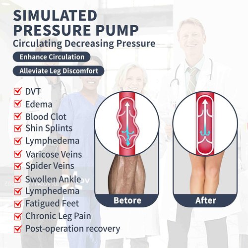 Medical Compression Thigh High Anti Embolism Stockings 15-20mmHg, for Edema, Varicose Veins, Swelling with Inspection Hole, Women & Men