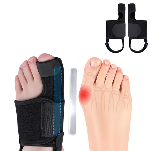Recovist Bunion Brace for Women & Men - Recovist Bunion Corrector & Big Toe Straightener. alleviation Pain & Corrects Toe Alignment. For Left & Right Foot (1 Pair)