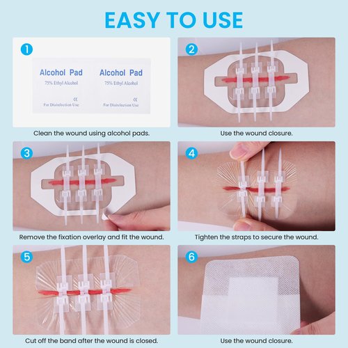 Antaly Wound Closure Strips, Zip Stitch Laceration Closure Kit, 12 PCS Butterfly Closure Bandages with Alcohol Pad & Dressings, Quick Clot Repair Wounds Without Stitches