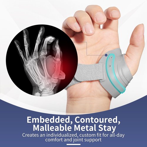 AKSO MEDICOS CMC Thumb Brace - Thumb Splint for CMC Joint Pain Relief and Support, Osteoarthritis, Tendonitis, Arthritis, CMC Joint Thumb Arthritis Brace for Women Men (Right Hand, Medium, Grey)