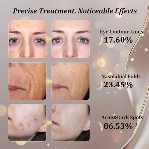 CUEME Red Light Therapy Mask - FDA-Cleared LED Treatment for Wrinkles & Acne | Portable Facial Care for Women