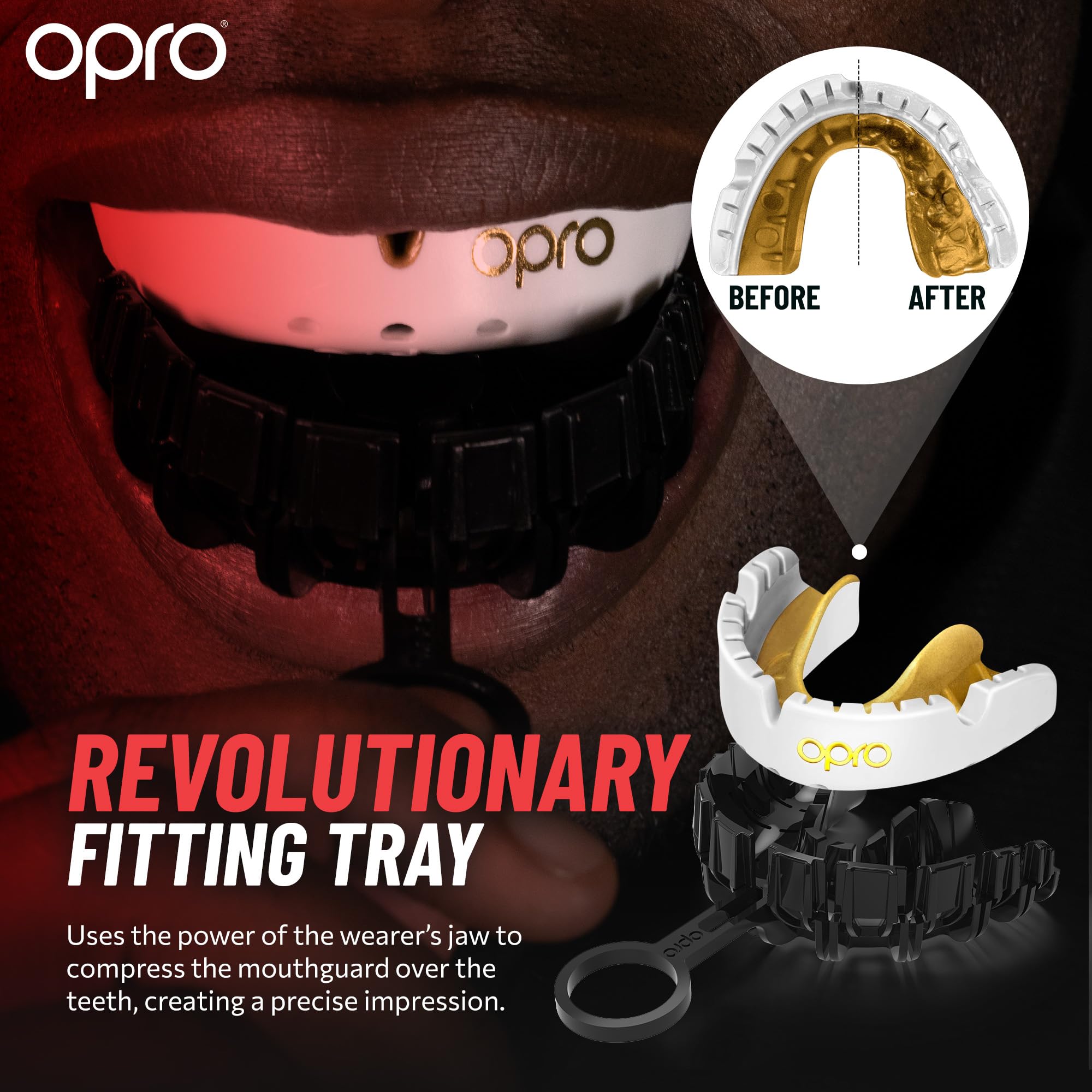 OPRO Gold Level Braces Mouth Guard, Moldable Mouthguard for Comfort & Fit for Boxing, Hockey, MMA, UFC, Football, Braces Protection, Youth & Adult Mouthguard with Case Included, Black