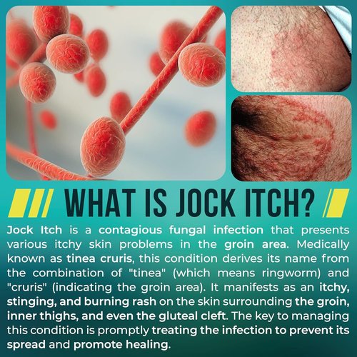 Jock Itch Spray - Antifungal Relief for Itchy Skin in Groin & Inner Thighs | Fast Absorption & Soothing Formula