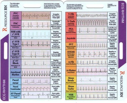 EKG Rhythm Interpretation Guide - Compact & Portable Reference Card for Quick Analysis | Dual Layout