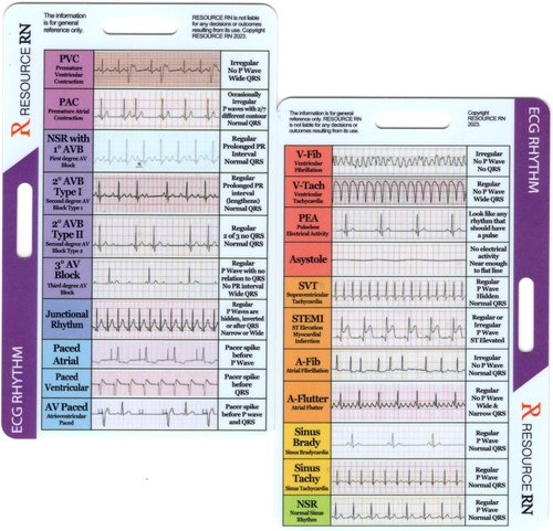 EKG Rhythm Interpretation Guide - Compact & Portable Reference Card for Quick Analysis | Dual Layout